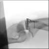 SPORK, NICO - 22.03.1976 - 04.08.2022 - Durchleuchtung UN OP - 10:59:22